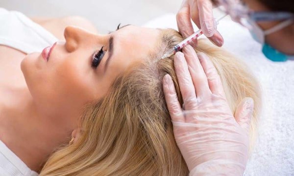 PRP Hair Plasma