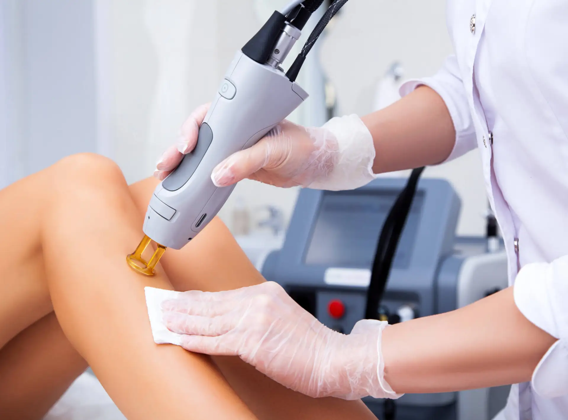 Laser hair removal