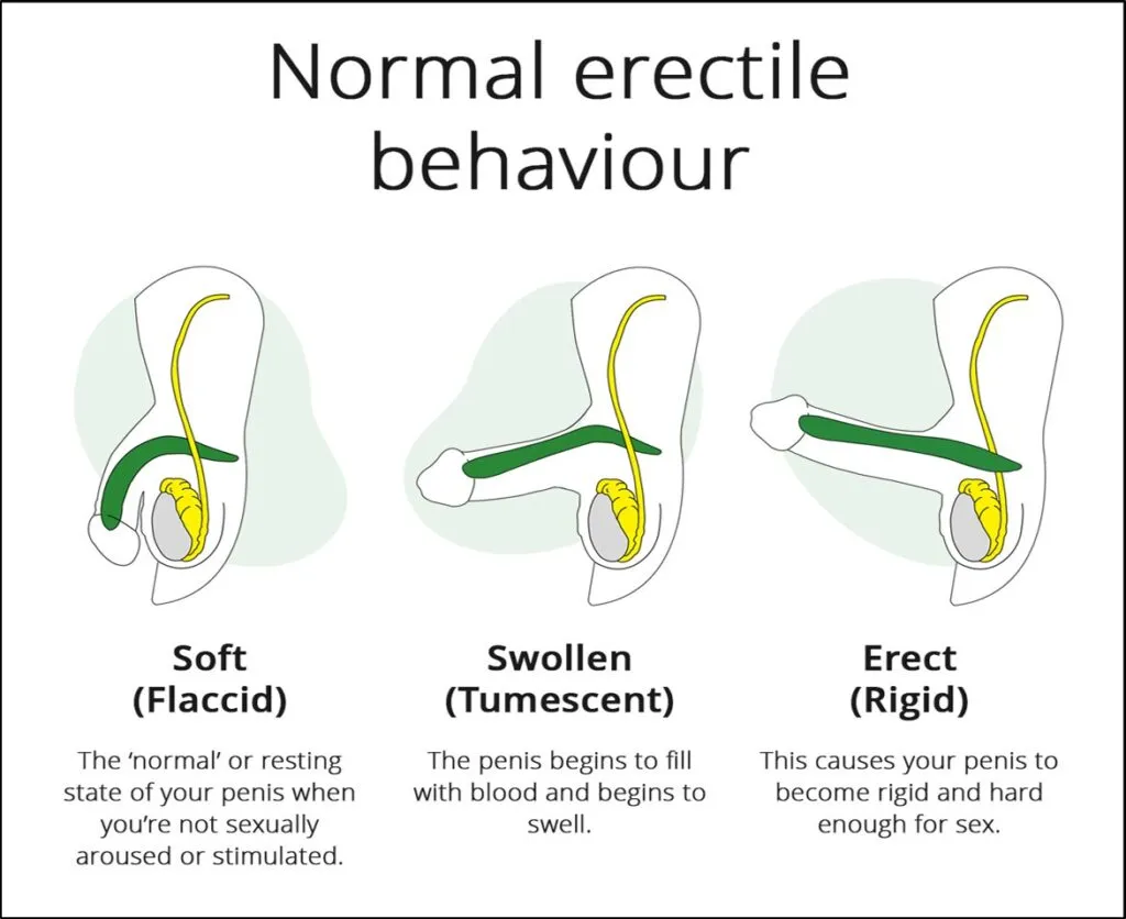 Treatment of erectile dysfunction (SVF)
