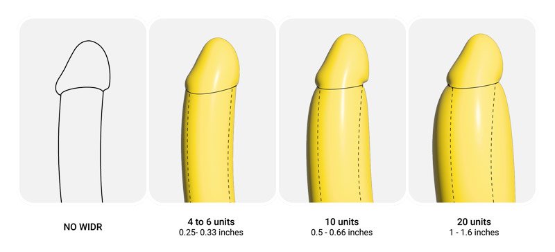 penile filler
