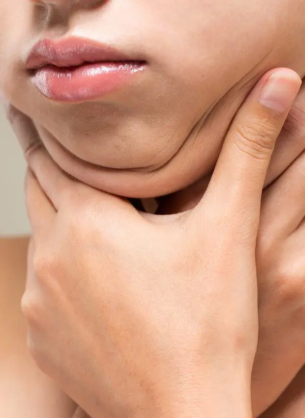 double-chin